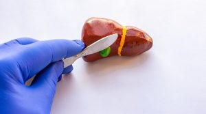 Maladies du foie et de la vésicule biliaire