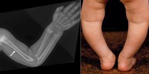 Maladies des enfants et des adolescents