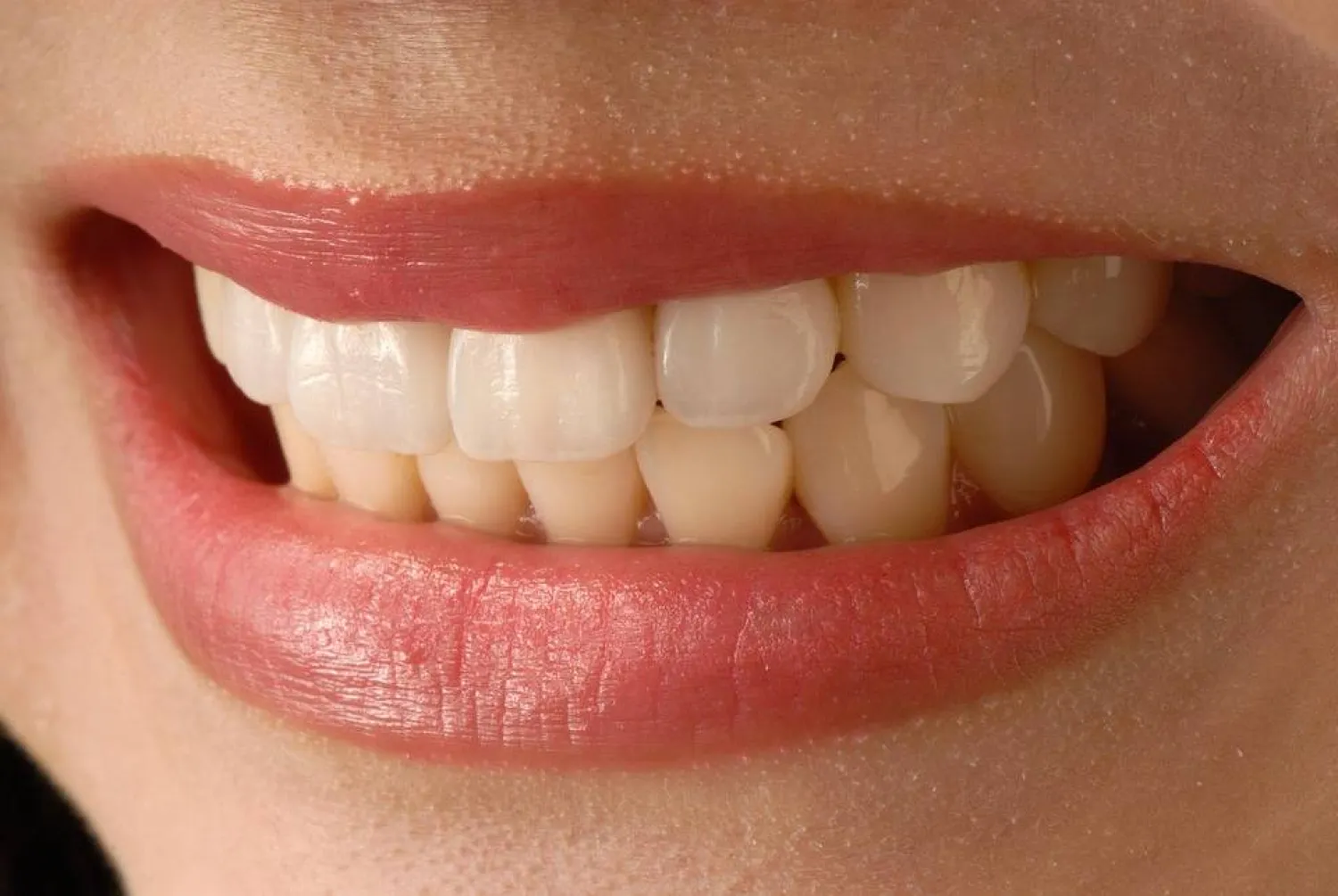 Innovations en régénération de l’émail dentaire : gel protéique révolutionnaire