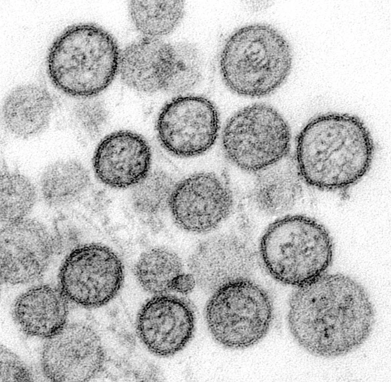 Syndrome pulmonaire à hantavirus : pathogénie, risques et enjeux médicaux